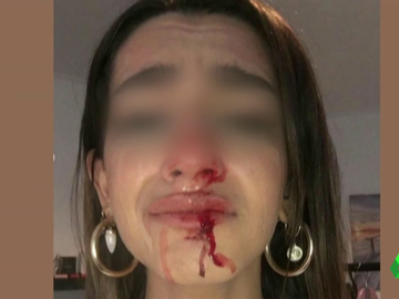 Una joven trans sufre una brutal paliza al grito de &quot;puto travelo&quot; y &quot;engendro&quot; a las puertas de su casa en Barcelona